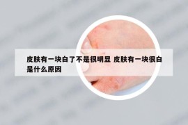 皮肤有一块白了不是很明显 皮肤有一块很白是什么原因