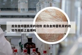 皮白金抑菌乳膏的功效 皮白金抑菌乳膏的功效作用脸上能用吗