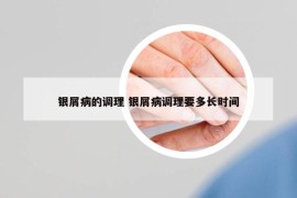 银屑病的调理 银屑病调理要多长时间