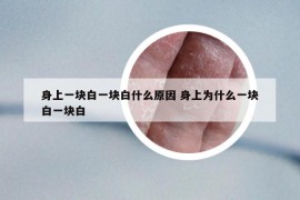 身上一块白一块白什么原因 身上为什么一块白一块白