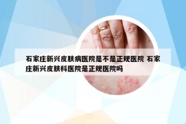 石家庄新兴皮肤病医院是不是正规医院 石家庄新兴皮肤科医院是正规医院吗