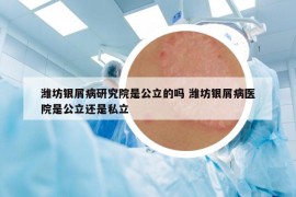 潍坊银屑病研究院是公立的吗 潍坊银屑病医院是公立还是私立