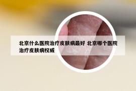 北京什么医院治疗皮肤病最好 北京哪个医院治疗皮肤病权威