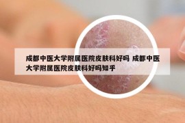 成都中医大学附属医院皮肤科好吗 成都中医大学附属医院皮肤科好吗知乎