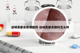 运城禹都皮肤病医院 运城禹都皮肤科怎么样