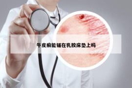 牛皮癣能铺在乳胶床垫上吗