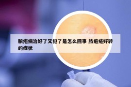 脓疱病治好了又犯了是怎么回事 脓疱疮好转的症状