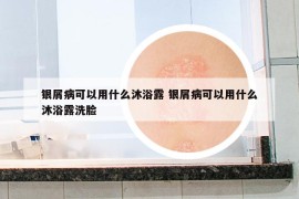 银屑病可以用什么沐浴露 银屑病可以用什么沐浴露洗脸