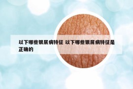 以下哪些银屑病特征 以下哪些银屑病特征是正确的