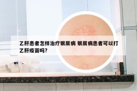 乙肝患者怎样治疗银屑病 银屑病患者可以打乙肝疫苗吗?