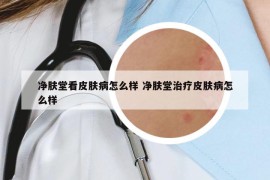 净肤堂看皮肤病怎么样 净肤堂治疗皮肤病怎么样