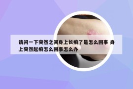 请问一下突然之间身上长癣了是怎么回事 身上突然起癣怎么回事怎么办