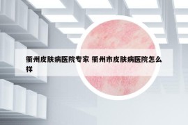 衢州皮肤病医院专家 衢州市皮肤病医院怎么样