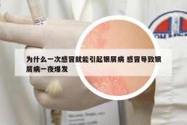 为什么一次感冒就能引起银屑病 感冒导致银屑病一夜爆发