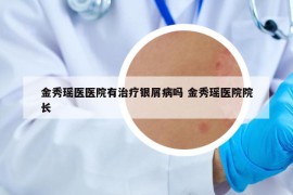 金秀瑶医医院有治疗银屑病吗 金秀瑶医院院长