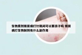 生物质剂银屑病打针期间可以要孩子吗 银屑病打生物制剂有什么副作用