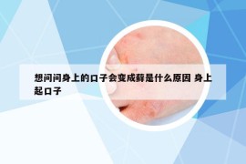 想问问身上的口子会变成藓是什么原因 身上起口子