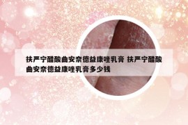 扶严宁醋酸曲安奈德益康唑乳膏 扶严宁醋酸曲安奈德益康唑乳膏多少钱