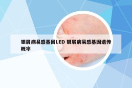 银屑病易感基因LED 银屑病易感基因遗传概率