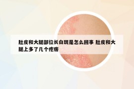 肚皮和大腿部位长白斑是怎么回事 肚皮和大腿上多了几个疙瘩