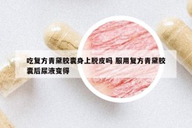 吃复方青黛胶囊身上脱皮吗 服用复方青黛胶囊后尿液变得