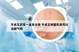 牛皮王药膏一盒多少钱 牛皮王抑菌乳膏可以治脚气吗