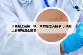 小孩脸上起癣一块一块的是怎么回事 小孩脸上有癣块怎么回事