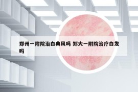 郑州一附院治白典风吗 郑大一附院治疗白发吗