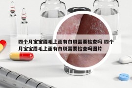 四个月宝宝眉毛上面有白斑需要检查吗 四个月宝宝眉毛上面有白斑需要检查吗图片