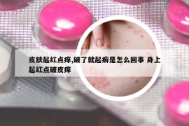 皮肤起红点痒,破了就起癣是怎么回事 身上起红点破皮痒