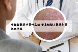 手和脚起脓疱是什么病 手上和脚上起脓包是怎么回事