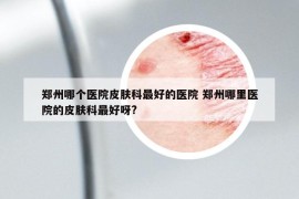 郑州哪个医院皮肤科最好的医院 郑州哪里医院的皮肤科最好呀?