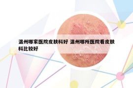 温州哪家医院皮肤科好 温州哪所医院看皮肤科比较好