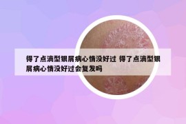 得了点滴型银屑病心情没好过 得了点滴型银屑病心情没好过会复发吗