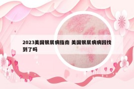 2023美国银屑病指南 美国银屑病病因找到了吗