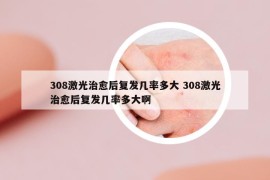 308激光治愈后复发几率多大 308激光治愈后复发几率多大啊