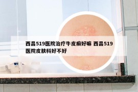 西昌519医院治疗牛皮癣好嘛 西昌519医院皮肤科好不好