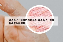 脚上长了一些红色点怎么办 脚上长了一些红色点怎么办很痛