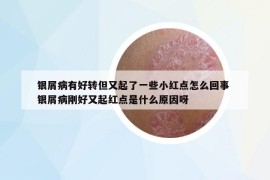 银屑病有好转但又起了一些小红点怎么回事 银屑病刚好又起红点是什么原因呀