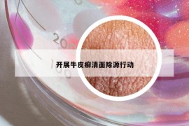 开展牛皮癣清面除源行动