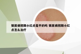 银屑病初期小红点是平的吗 银屑病初期小红点怎么治疗