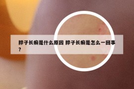 脖子长癣是什么原因 脖子长癣是怎么一回事?