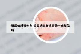 银屑病感冒咋办 银屑病患者感冒就一定复发吗