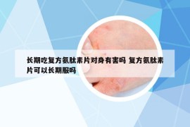 长期吃复方氨肽素片对身有害吗 复方氨肽素片可以长期服吗