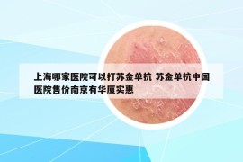 上海哪家医院可以打苏金单抗 苏金单抗中国医院售价南京有华厦实惠