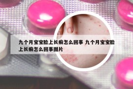 九个月宝宝脸上长癣怎么回事 九个月宝宝脸上长癣怎么回事图片