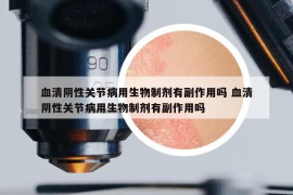 血清阴性关节病用生物制剂有副作用吗 血清阴性关节病用生物制剂有副作用吗