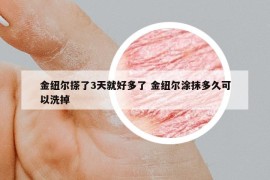 金纽尔搽了3天就好多了 金纽尔涂抹多久可以洗掉