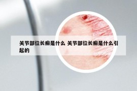 关节部位长癣是什么 关节部位长癣是什么引起的