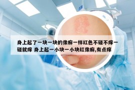 身上起了一块一块的像癣一样红色不碰不痒一碰就痒 身上起一小块一小块红像癣,有点痒